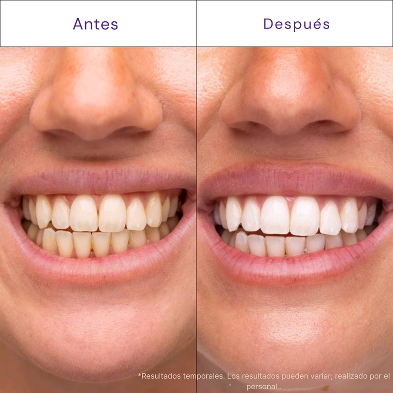 RESULTADOS PROFESIONALES